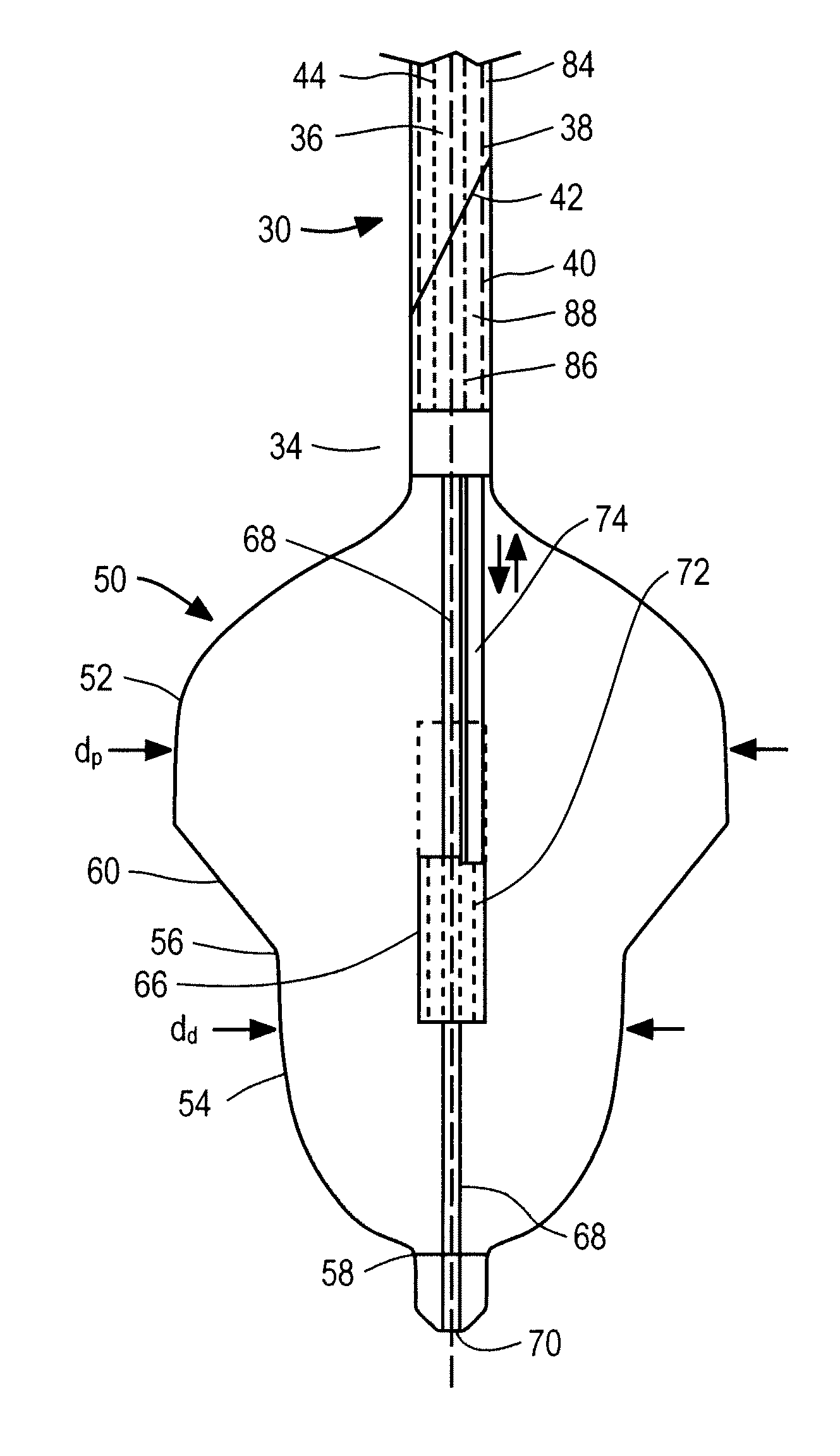 Methods and apparatus for treatment of mitral valve insufficiency