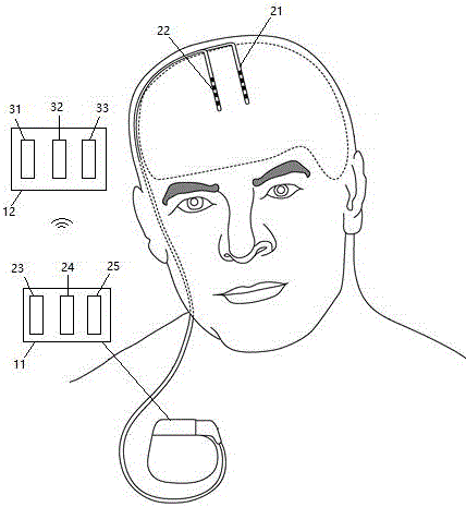 Fast-charging controlled deep brain stimulation bleeding detection system