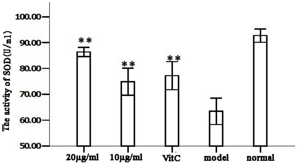 Use of human amniotic mesenchymal stem cell exosome