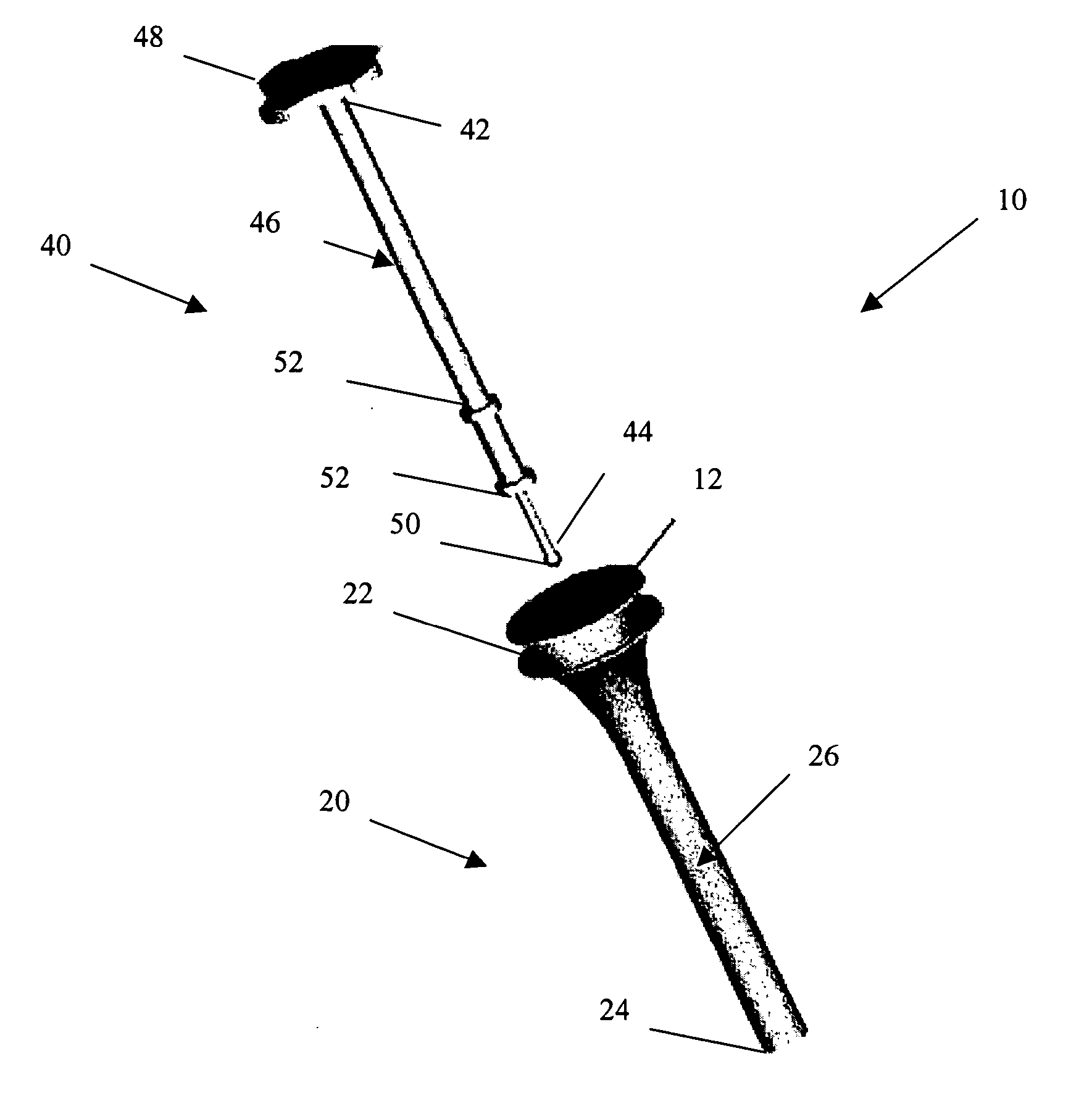 Arthroscopic tissue scaffold delivery device