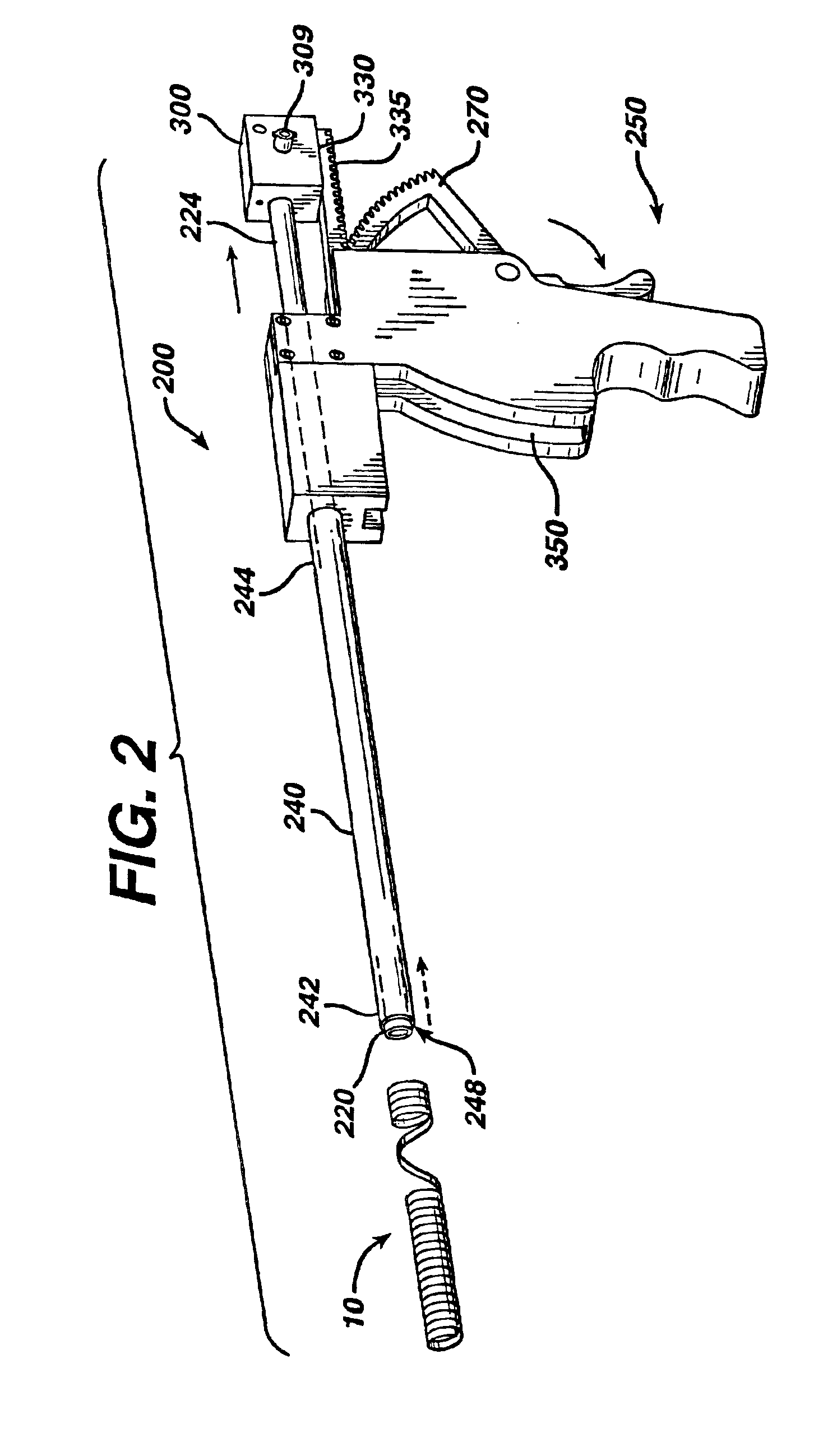 Removable stent for body lumens