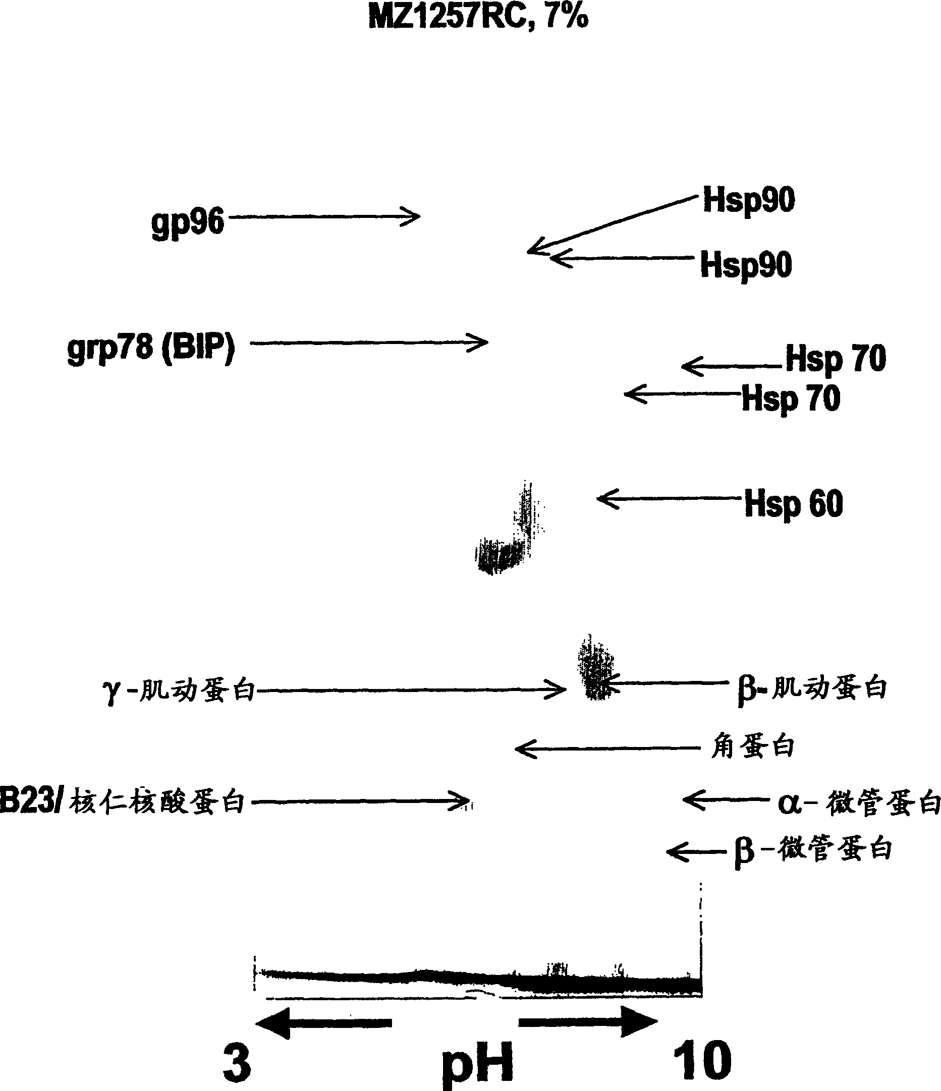 Renal cell carcinoma markers