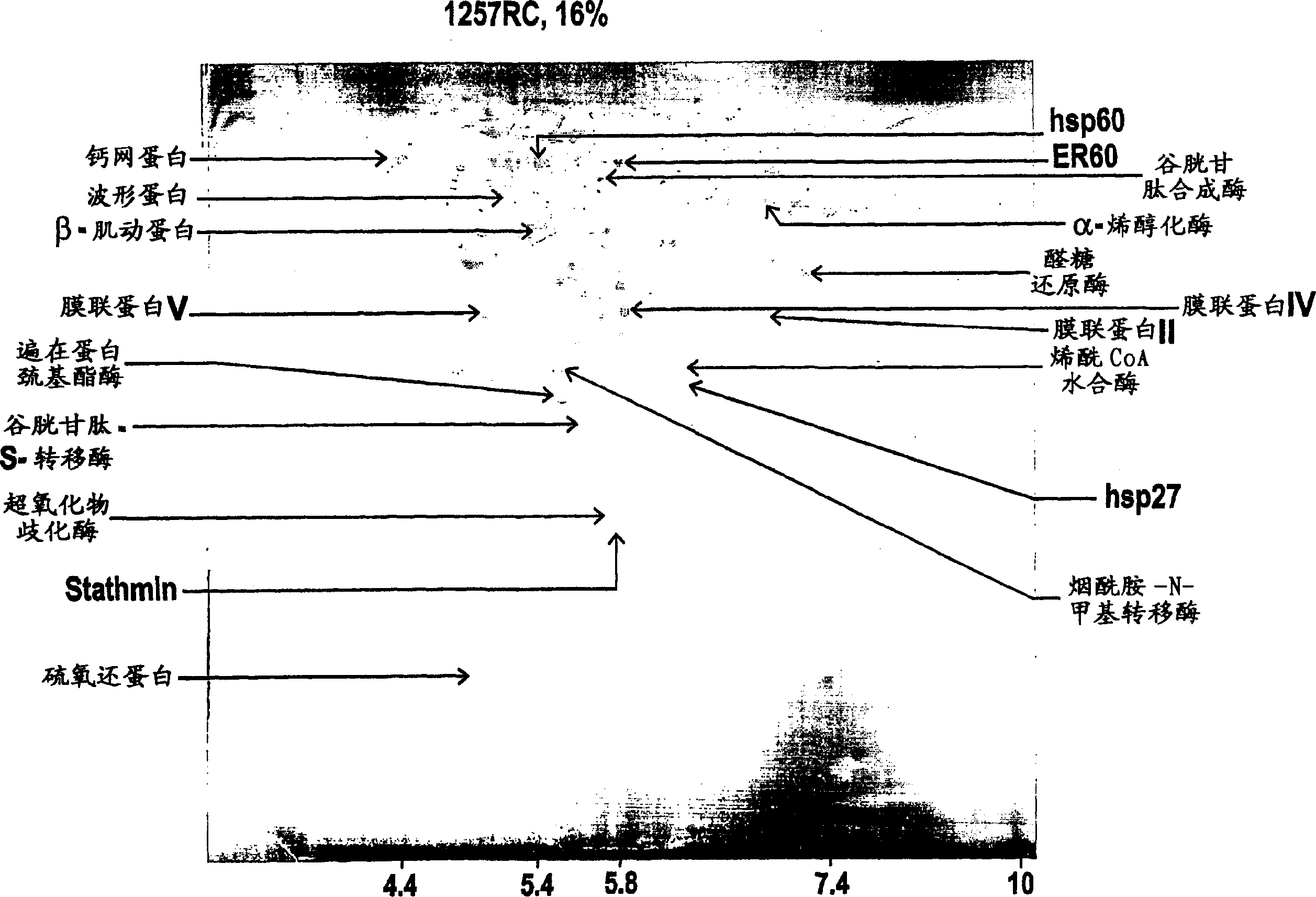 Renal cell carcinoma markers