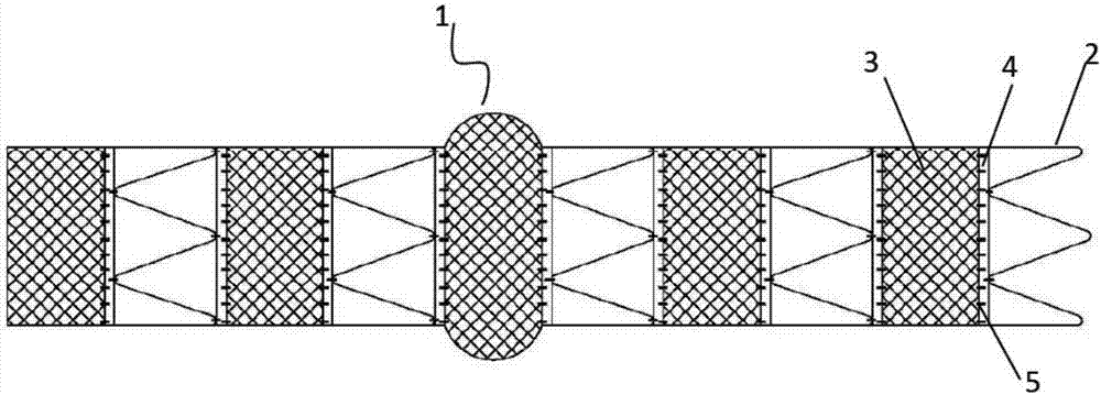 Non-covered vascular scaffold and method of releasing same