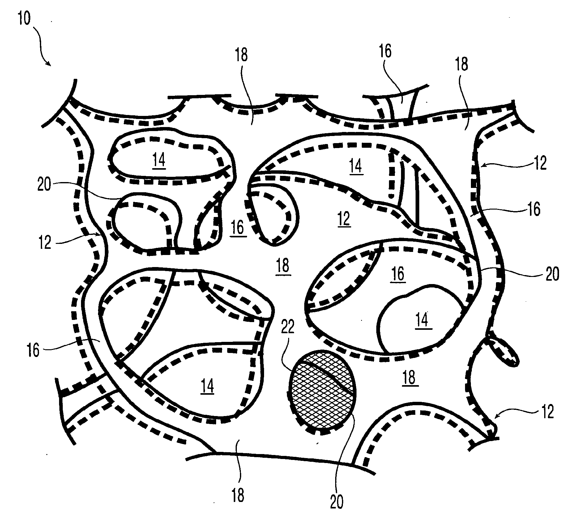 Reticulated elastomeric matrices, their manufacture and use in implantable devices