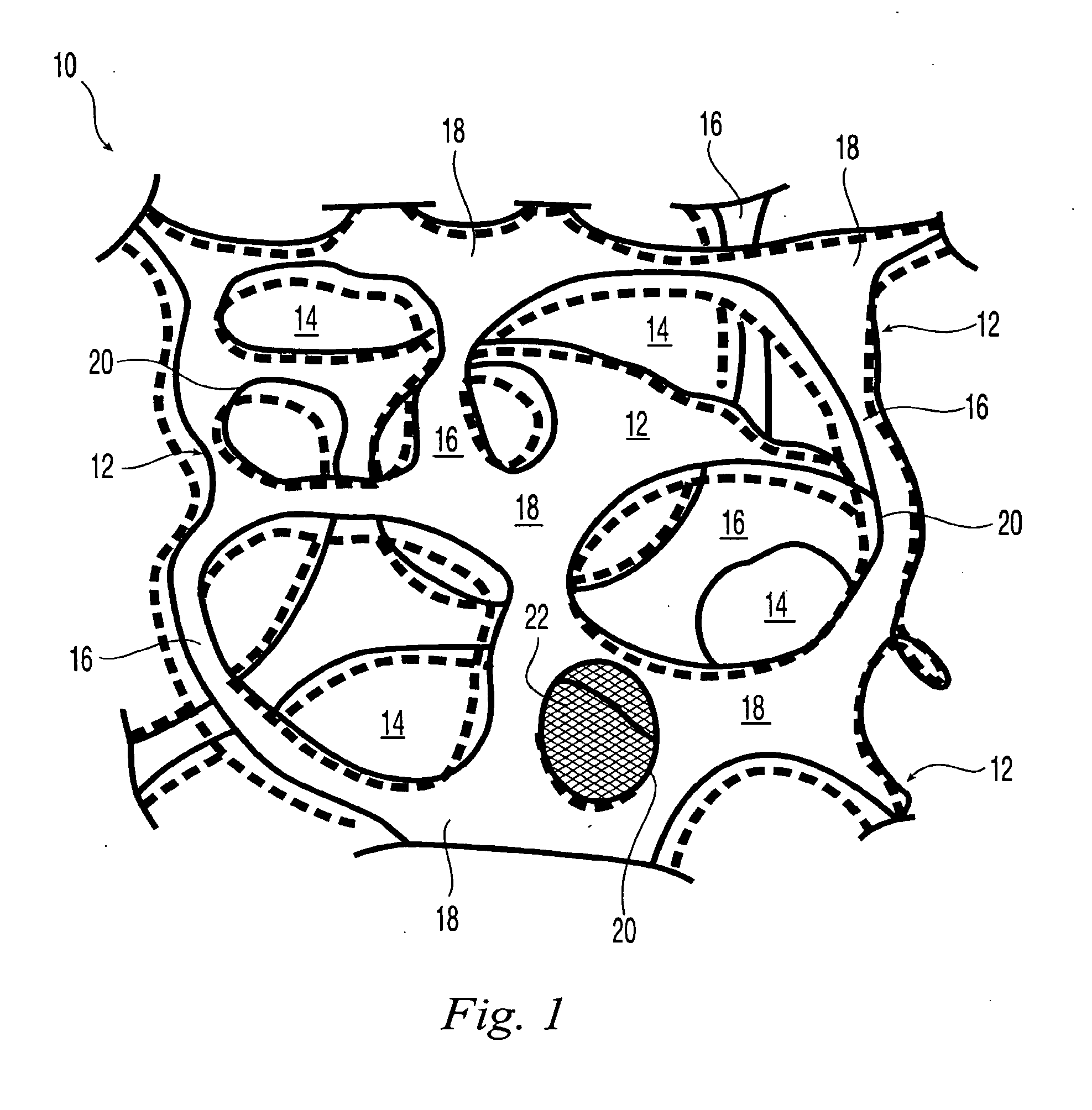 Reticulated elastomeric matrices, their manufacture and use in implantable devices