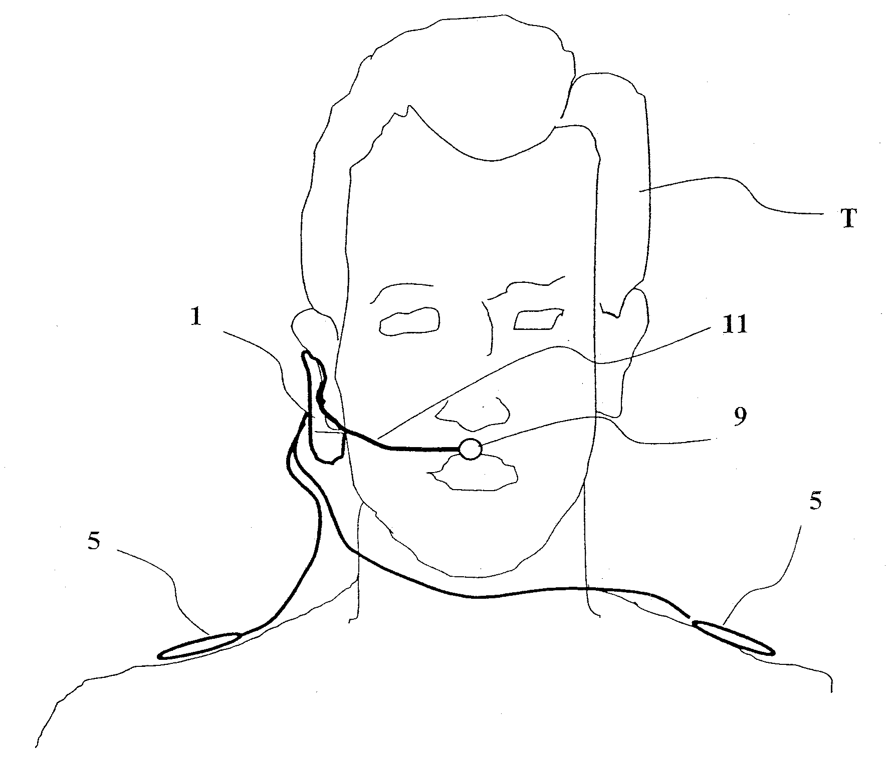 Device and method for determining a respiration rate