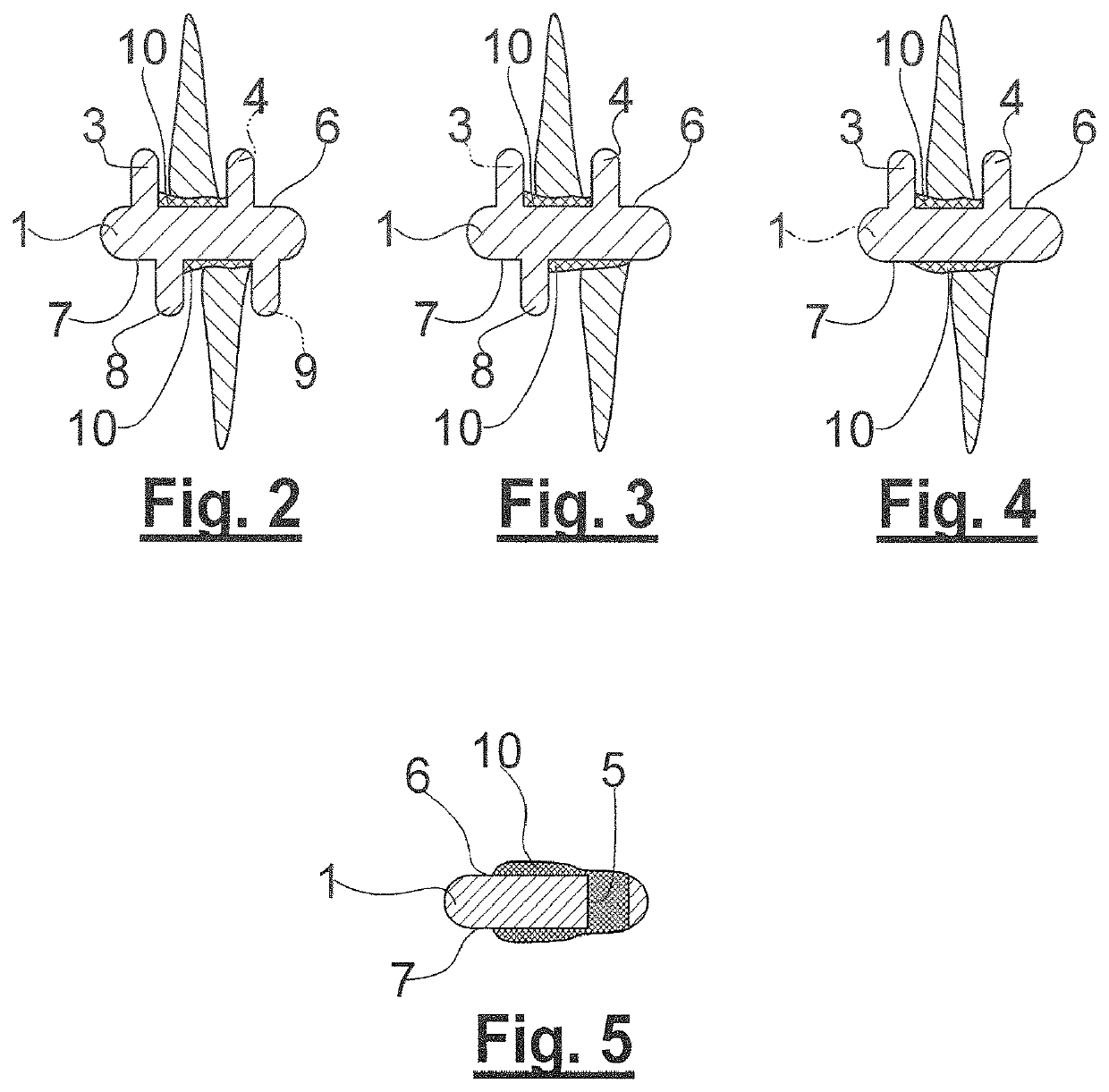 Tooth cleaning device