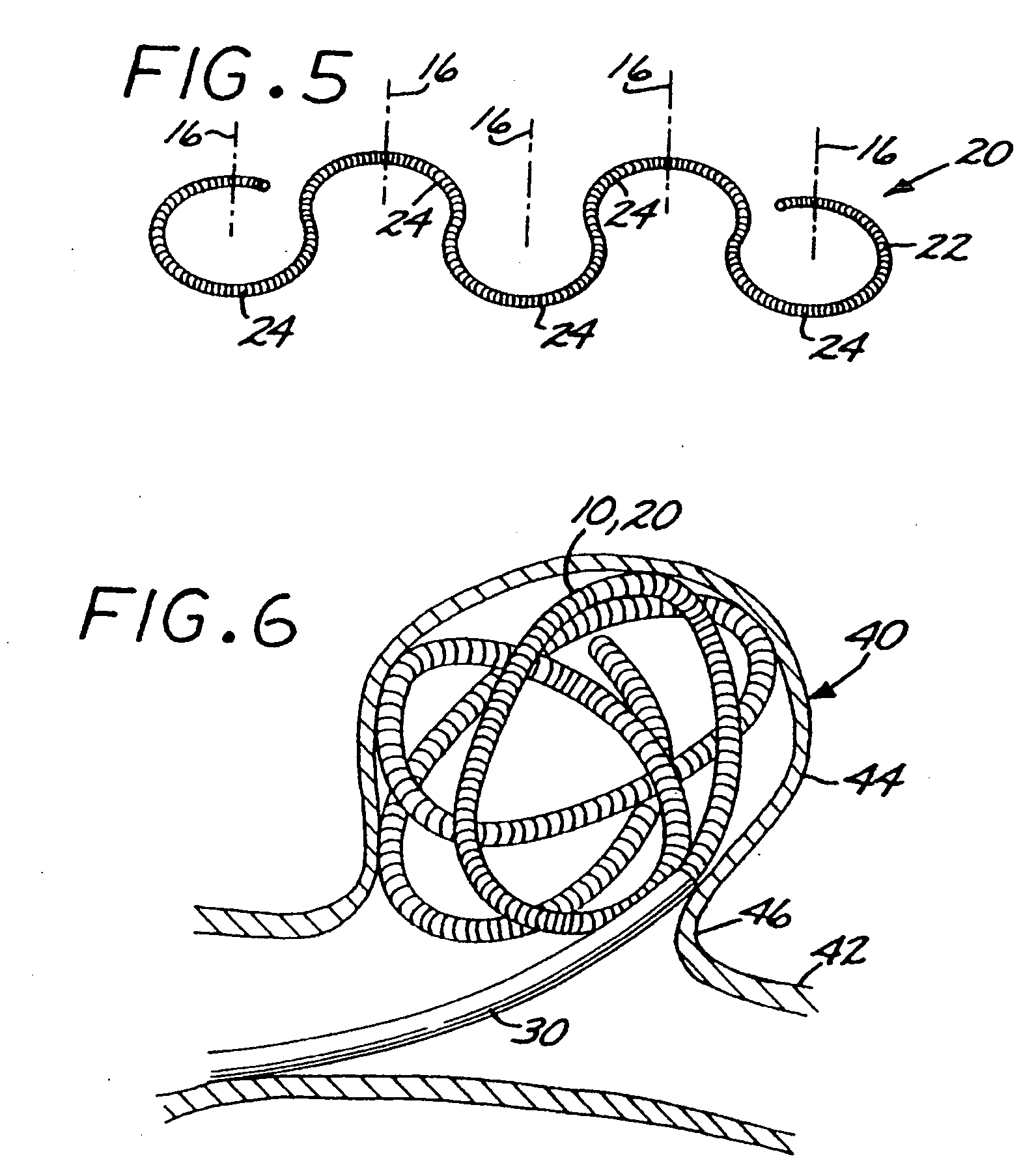 Microcoil vaso-occlusive device with multi-axis secondary configuration