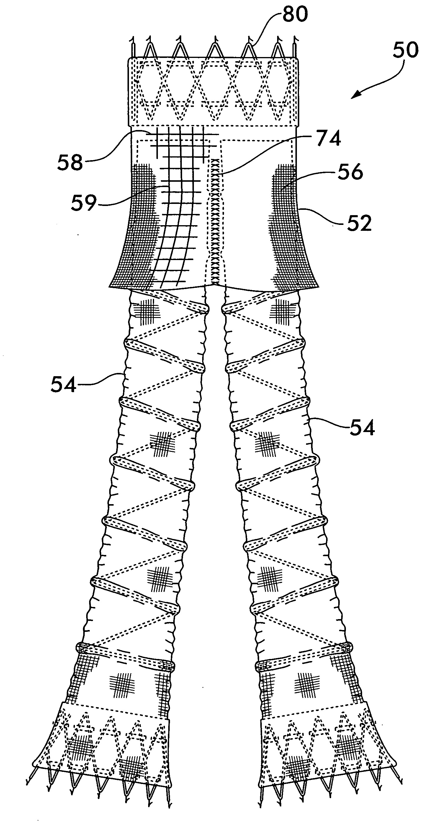 Integral support stent graft assembly