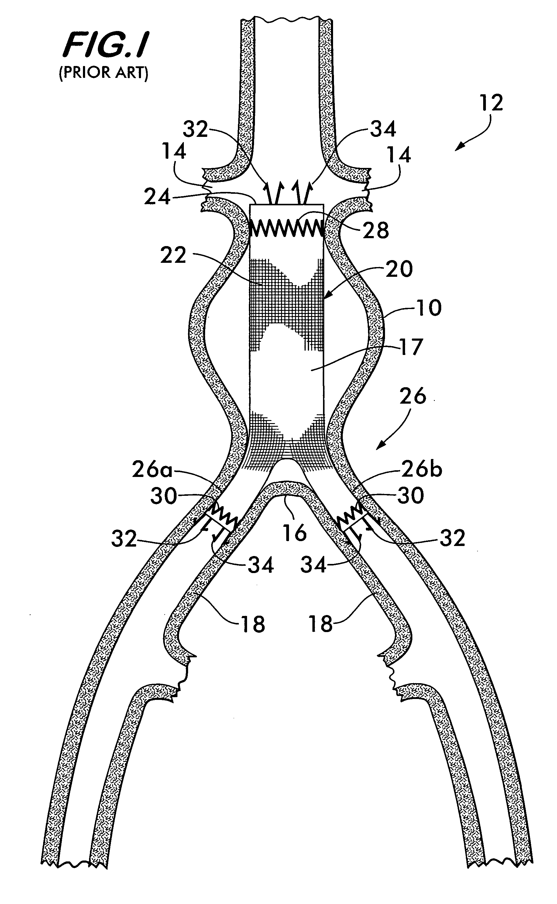 Integral support stent graft assembly