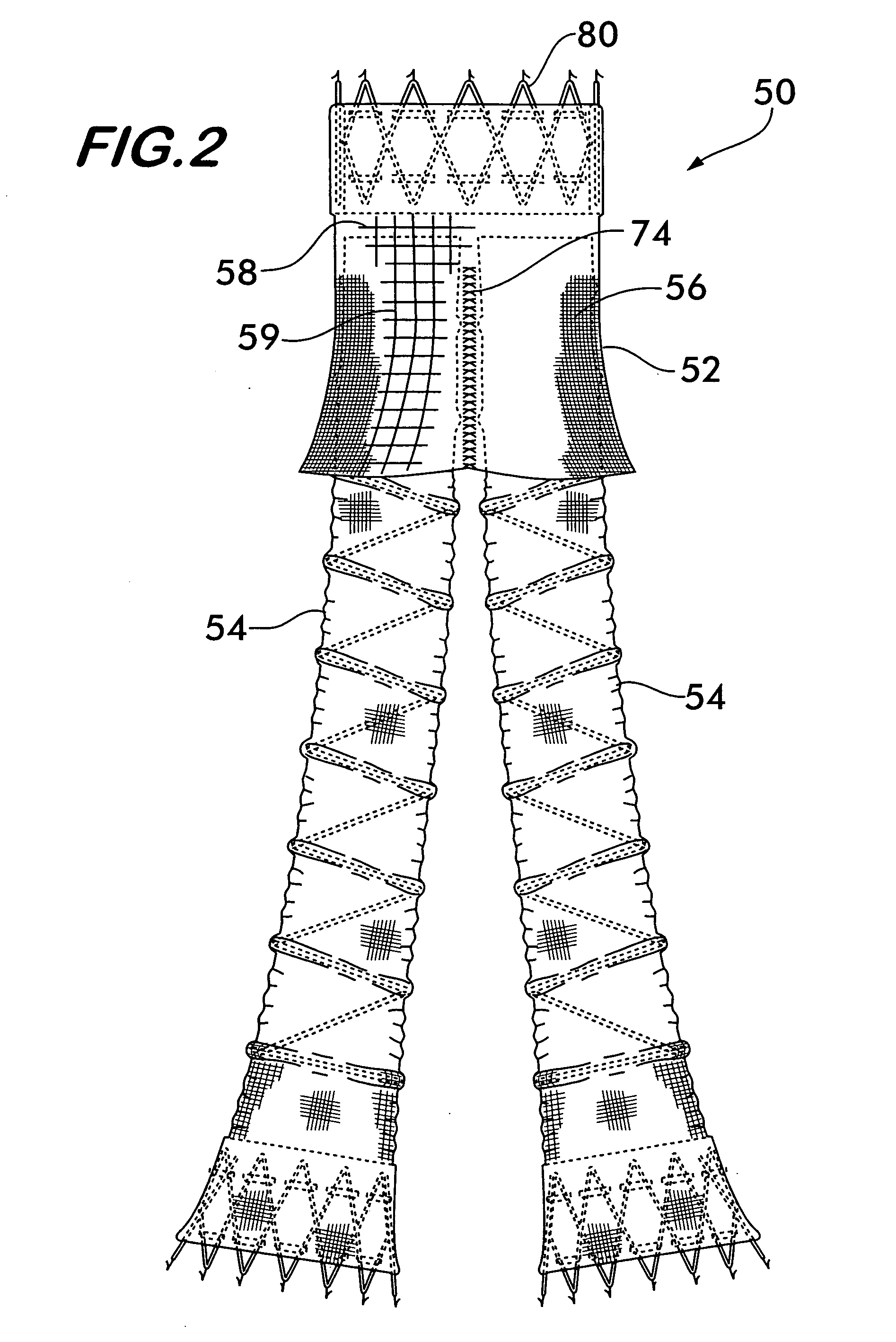 Integral support stent graft assembly