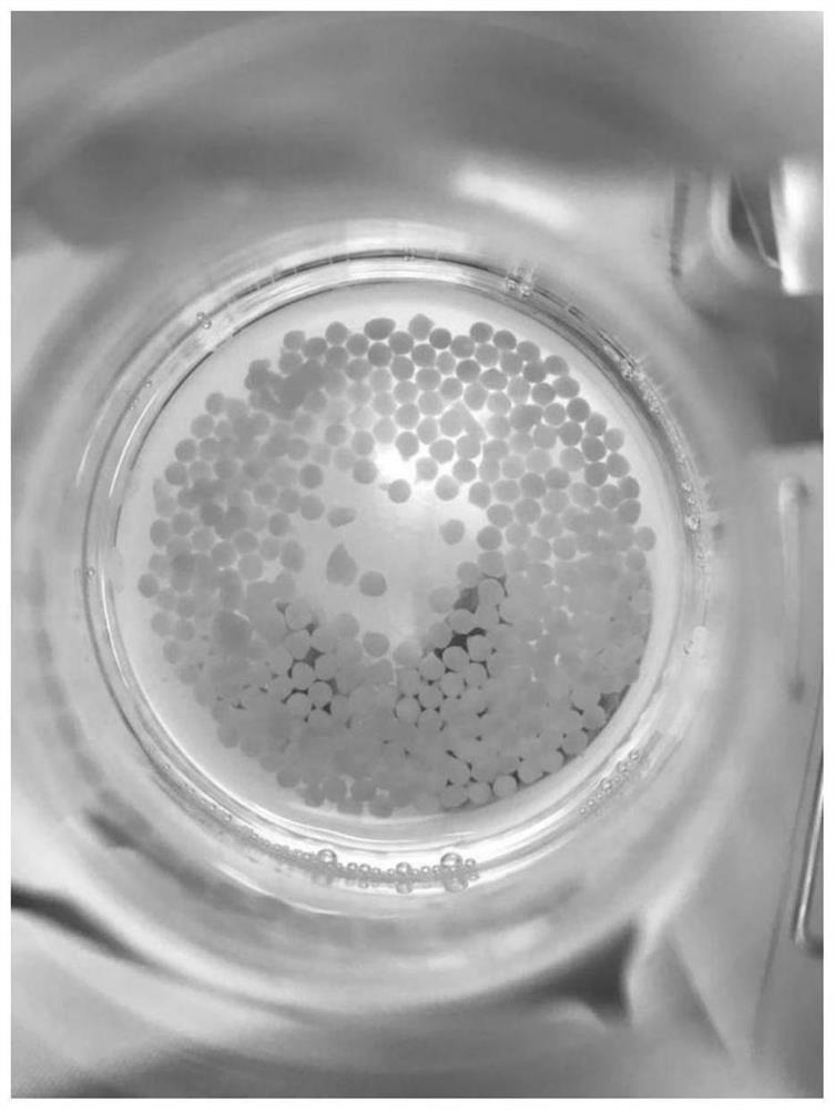 Method for treating sewage by virtue of immobilized chlorella and rhodotorula benthica and application