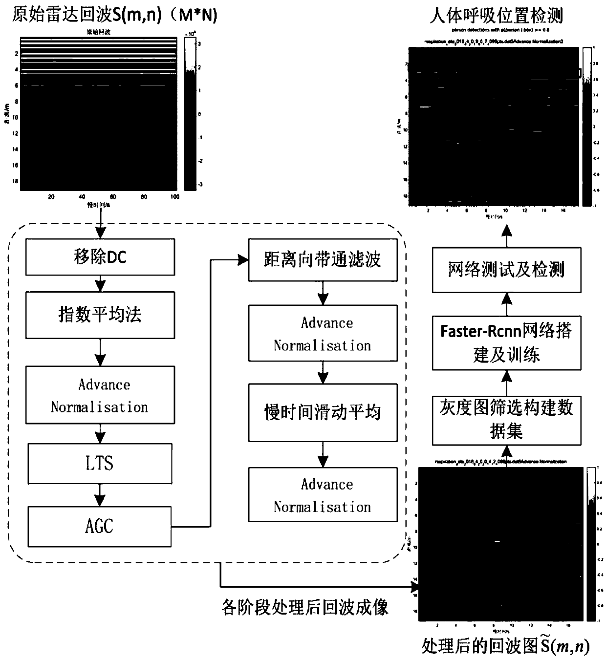 Through-wall ultra-wideband radar human body respiration signal detection method based on Faster-RCNN network