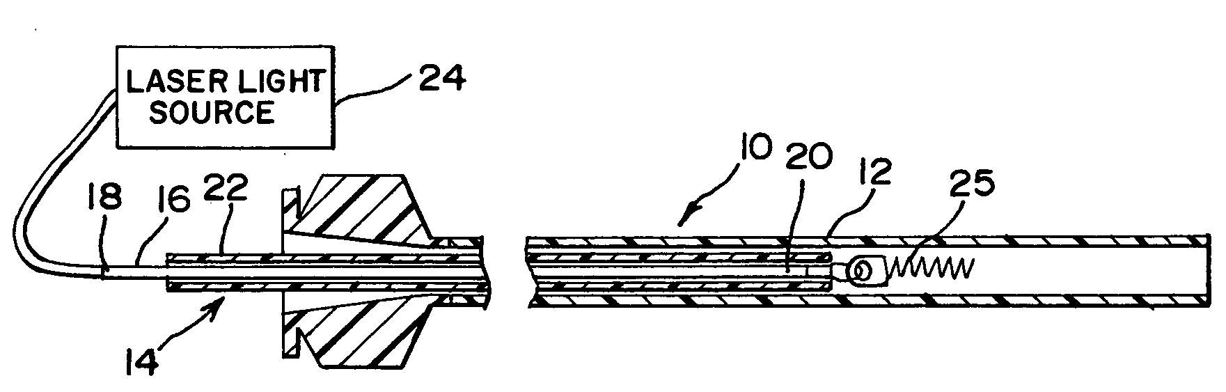 Laser-based vascular occlusion device detachment system