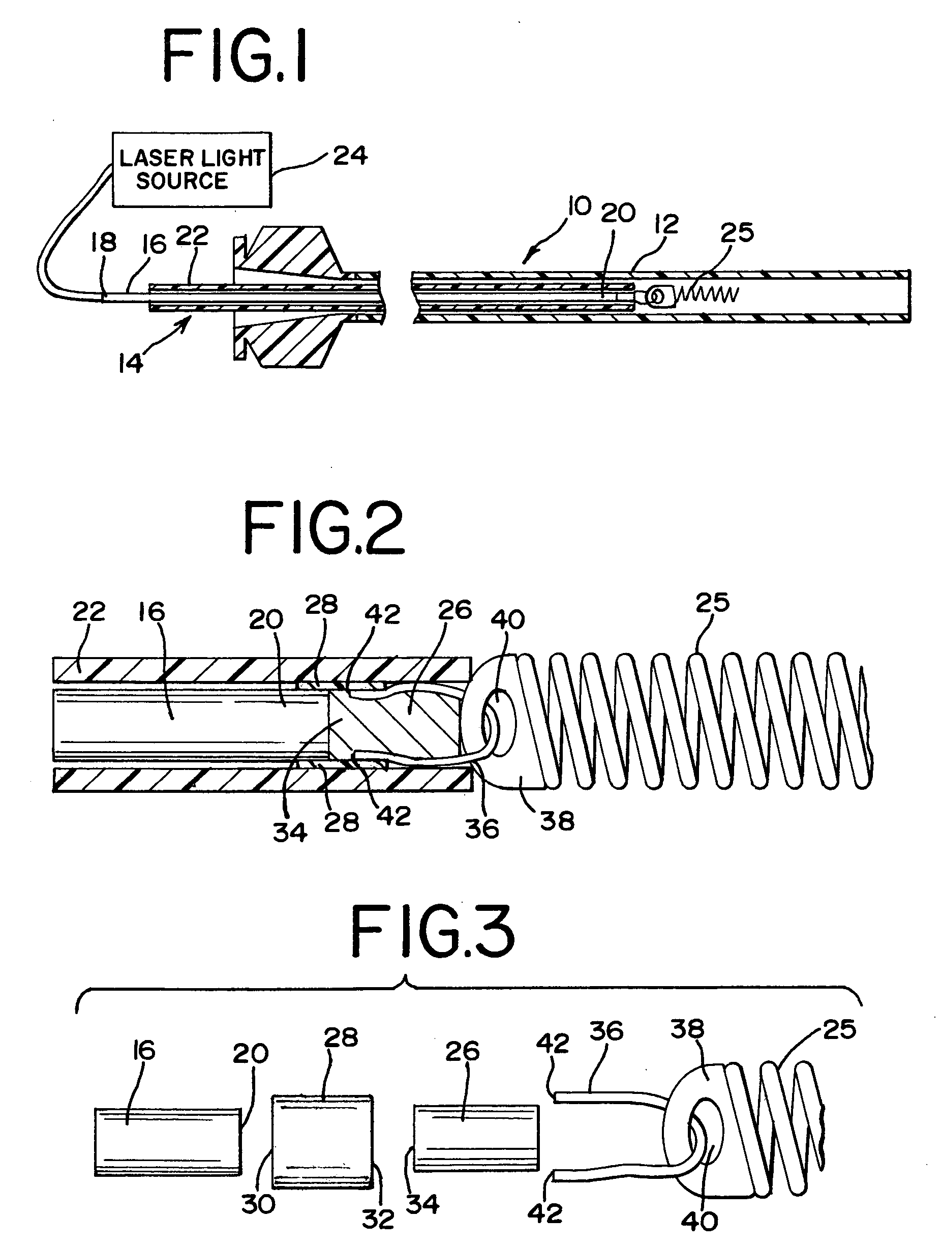 Laser-based vascular occlusion device detachment system