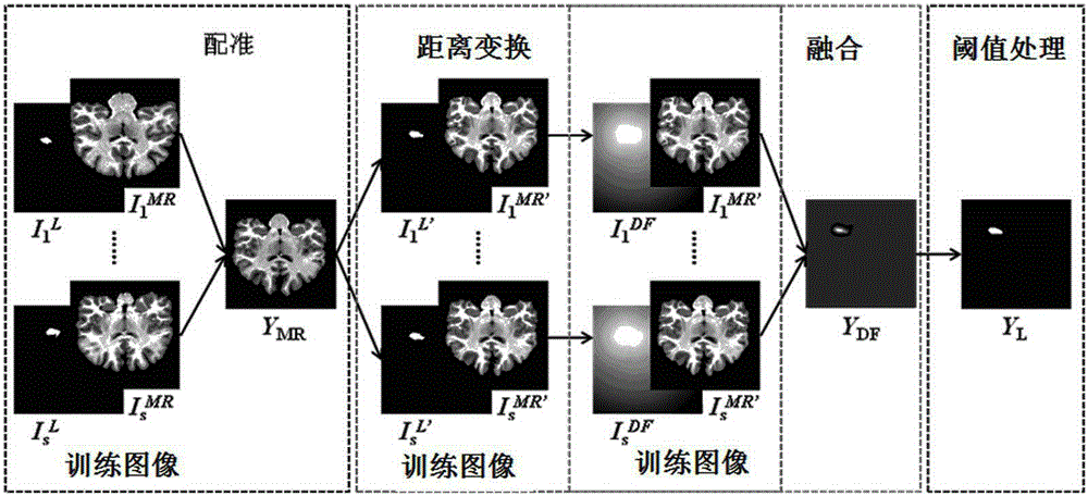 Distance-field-fusion-based hippocampus segmentation method of MR image