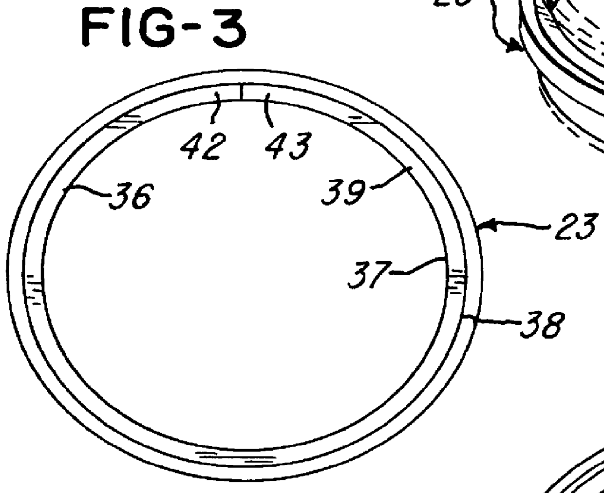 Suture ring for heart valve prosthesis