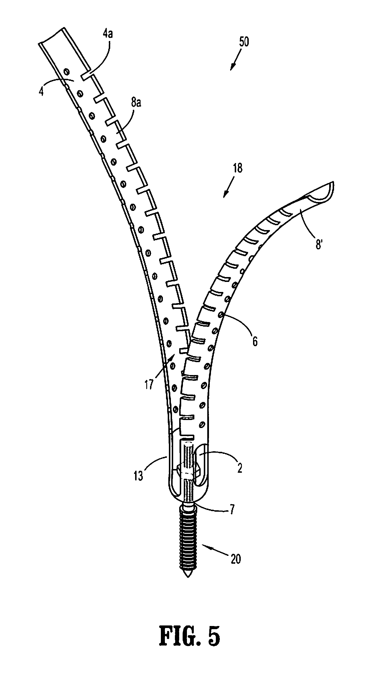 Minimally invasive retractor and posted screw