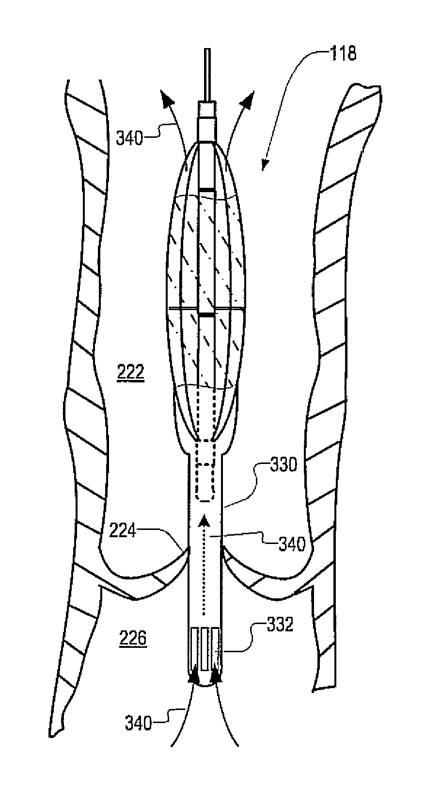 Medical device