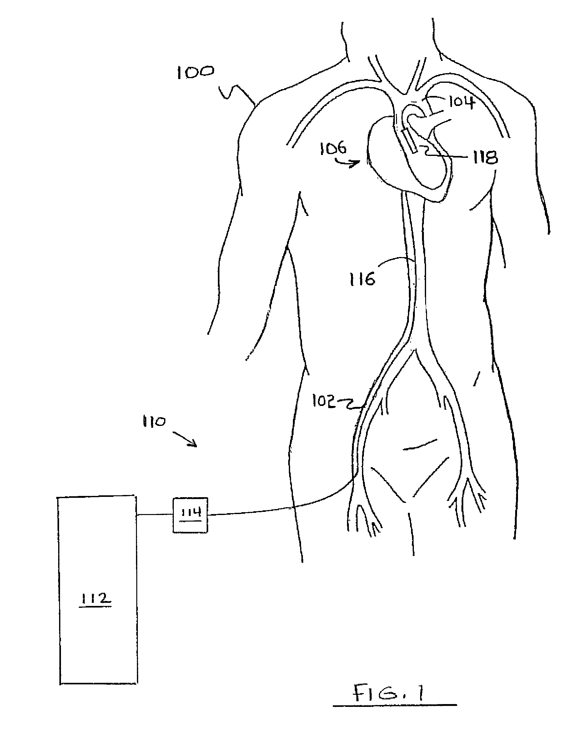 Medical device