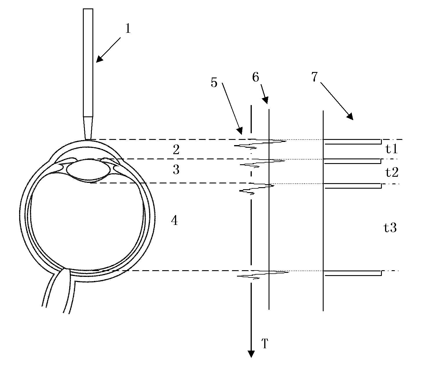 Adaptive time-gain compensation method for use in ophthalmic ultrasonic measurement equipment