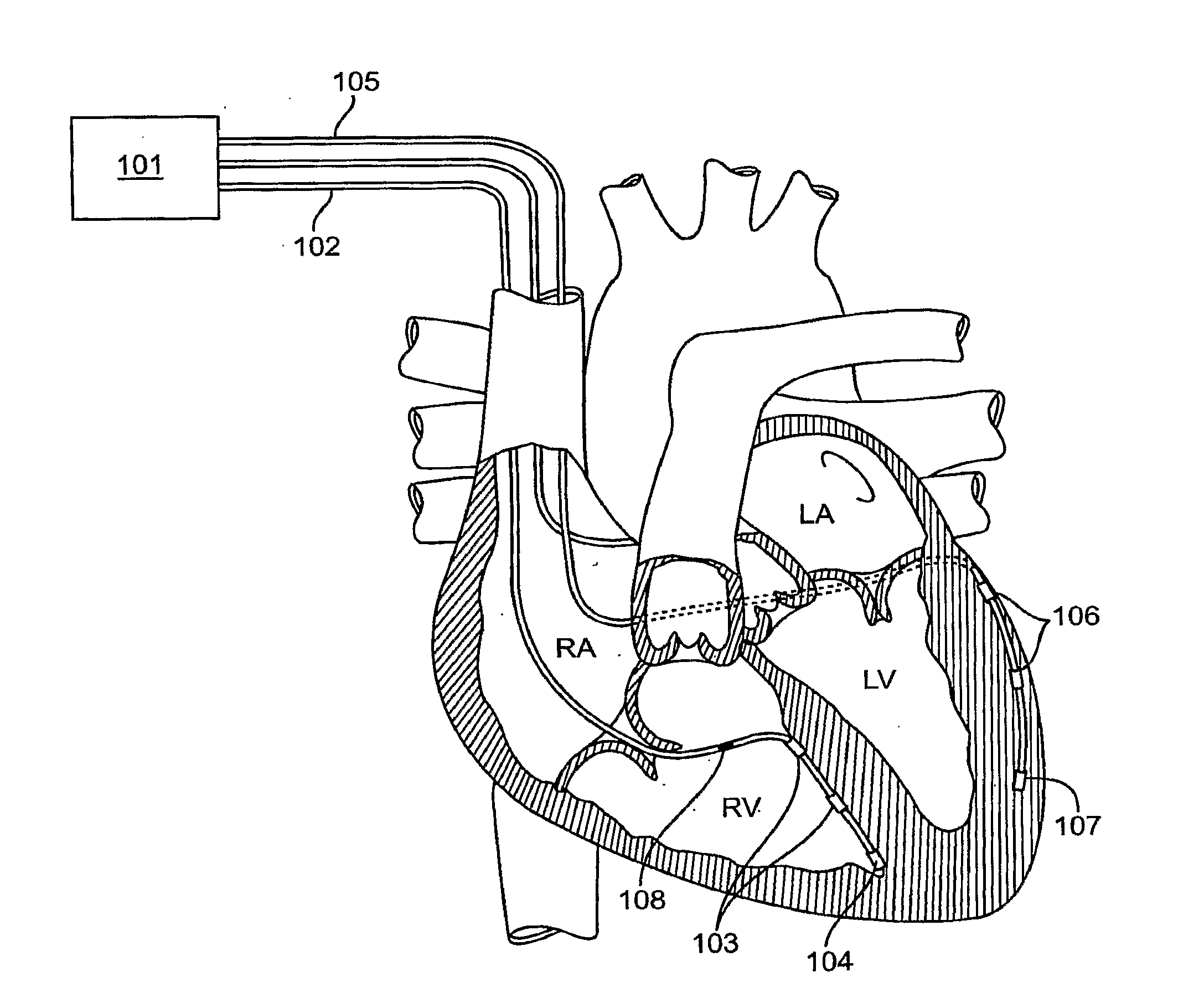 Implantable integrated circuit