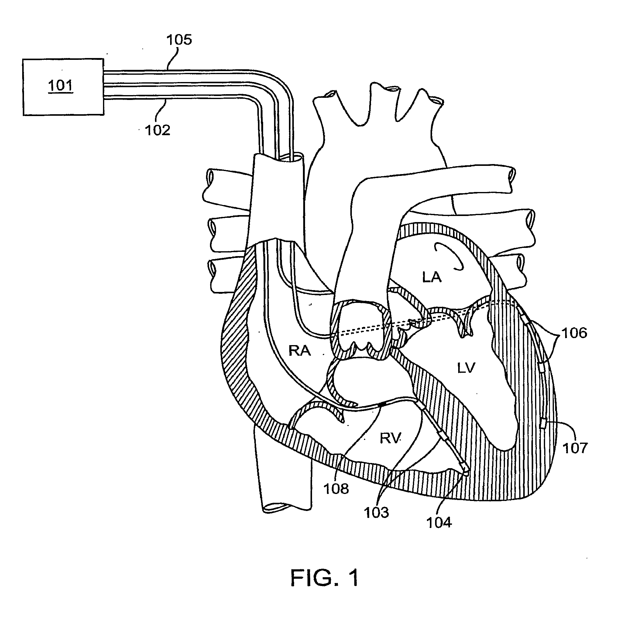 Implantable integrated circuit