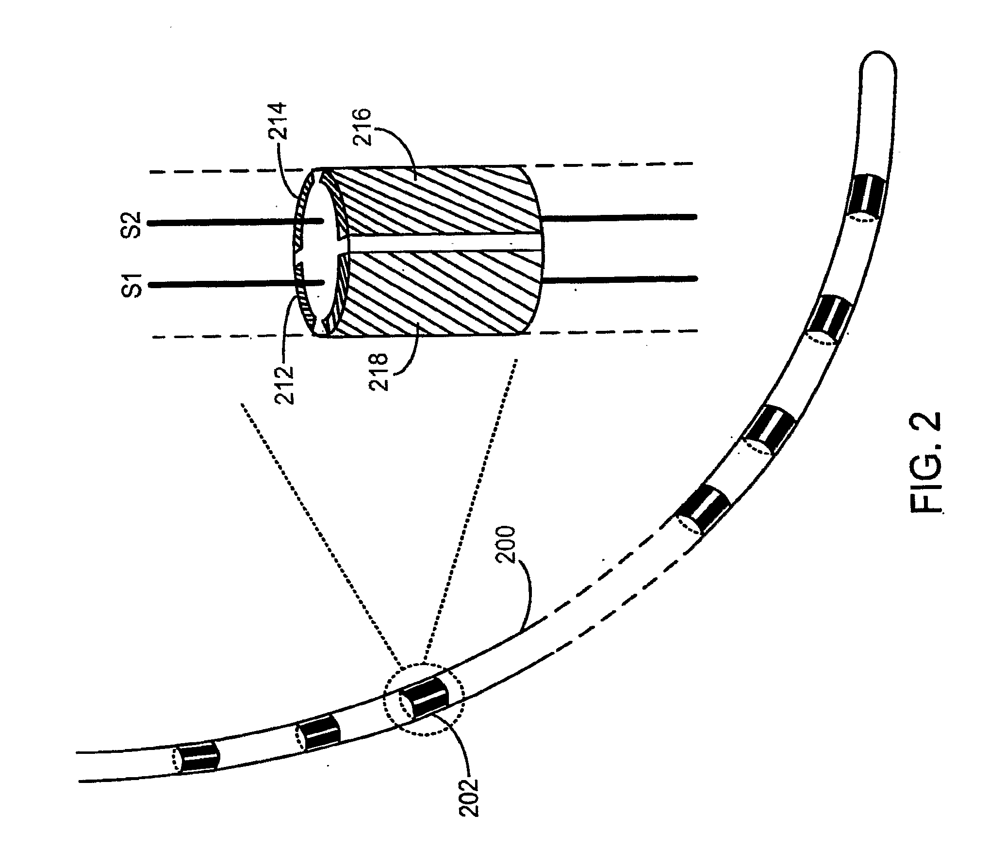 Implantable integrated circuit