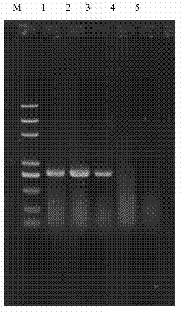 Kit and method for detecting TYLCV (tomato yellow leaf curl virus) carried by tomato seedlings