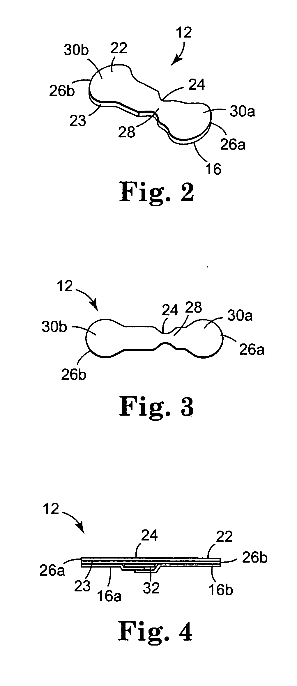 Wound closure system and method