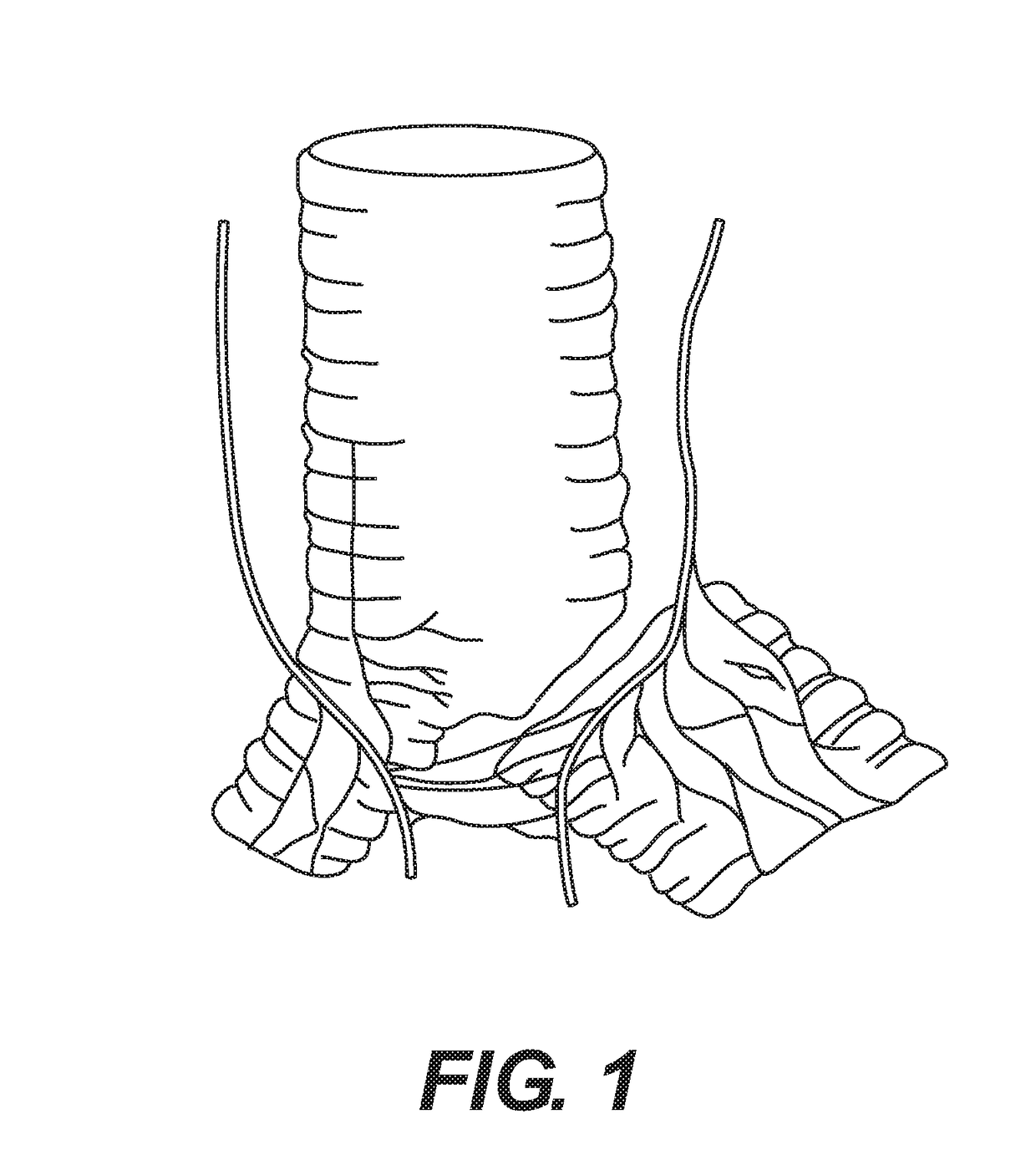 Neuromodulation device