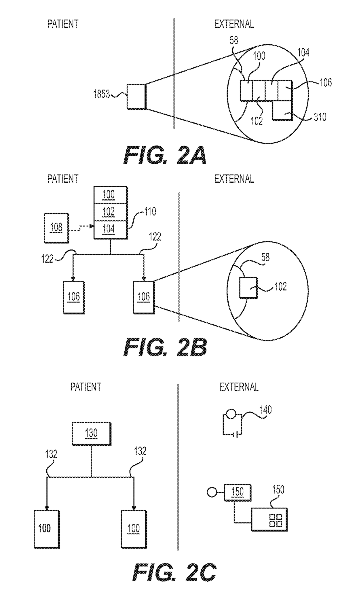 Neuromodulation device