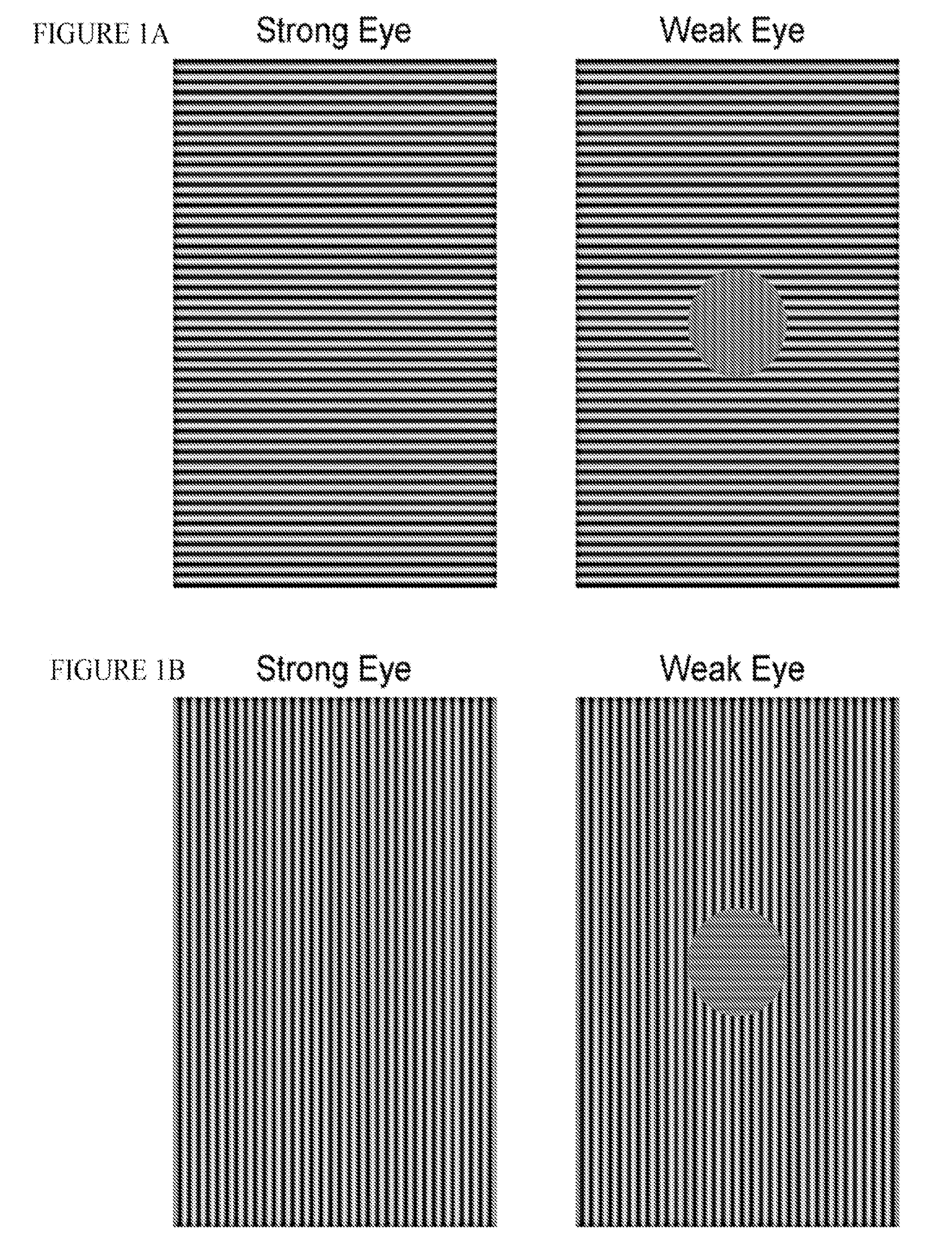 Systems and methods for improving sensory eye dominance, binocular imbalance, and/or stereopsis in a subject