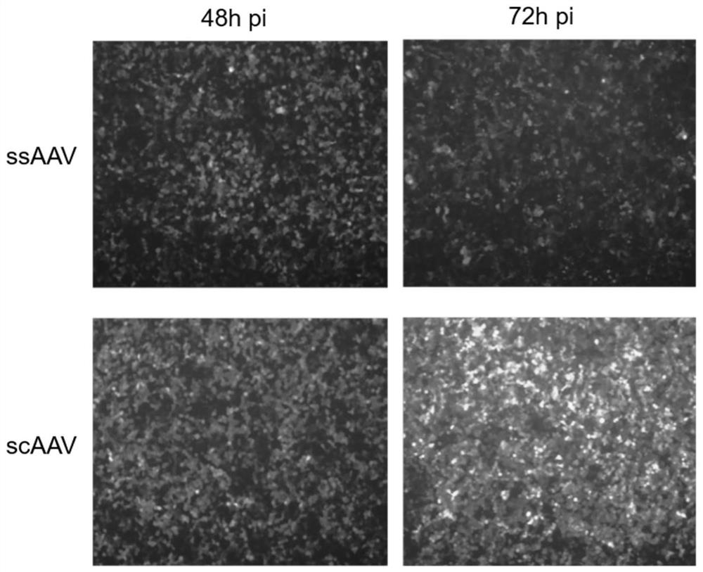 Expression vector, recombinant adeno-associated virus and application of recombinant adeno-associated virus in preparation of novel 2019 coronavirus vaccine