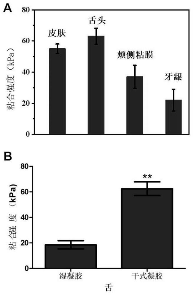 A dry gel patch for photodynamic therapy of oral precancerous lesions and its preparation method