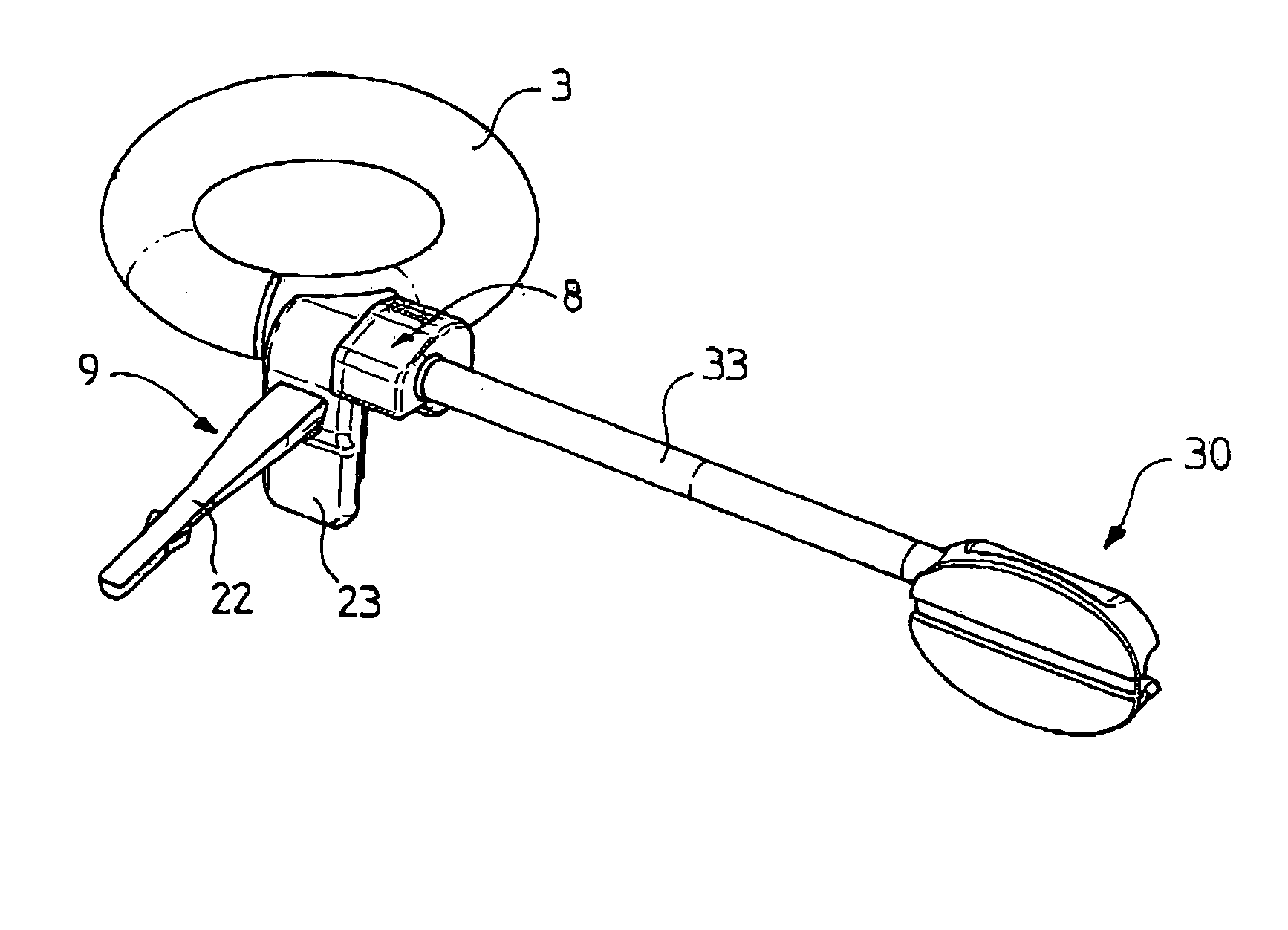 Surgical ring featuring a reversiblediameter remote control system