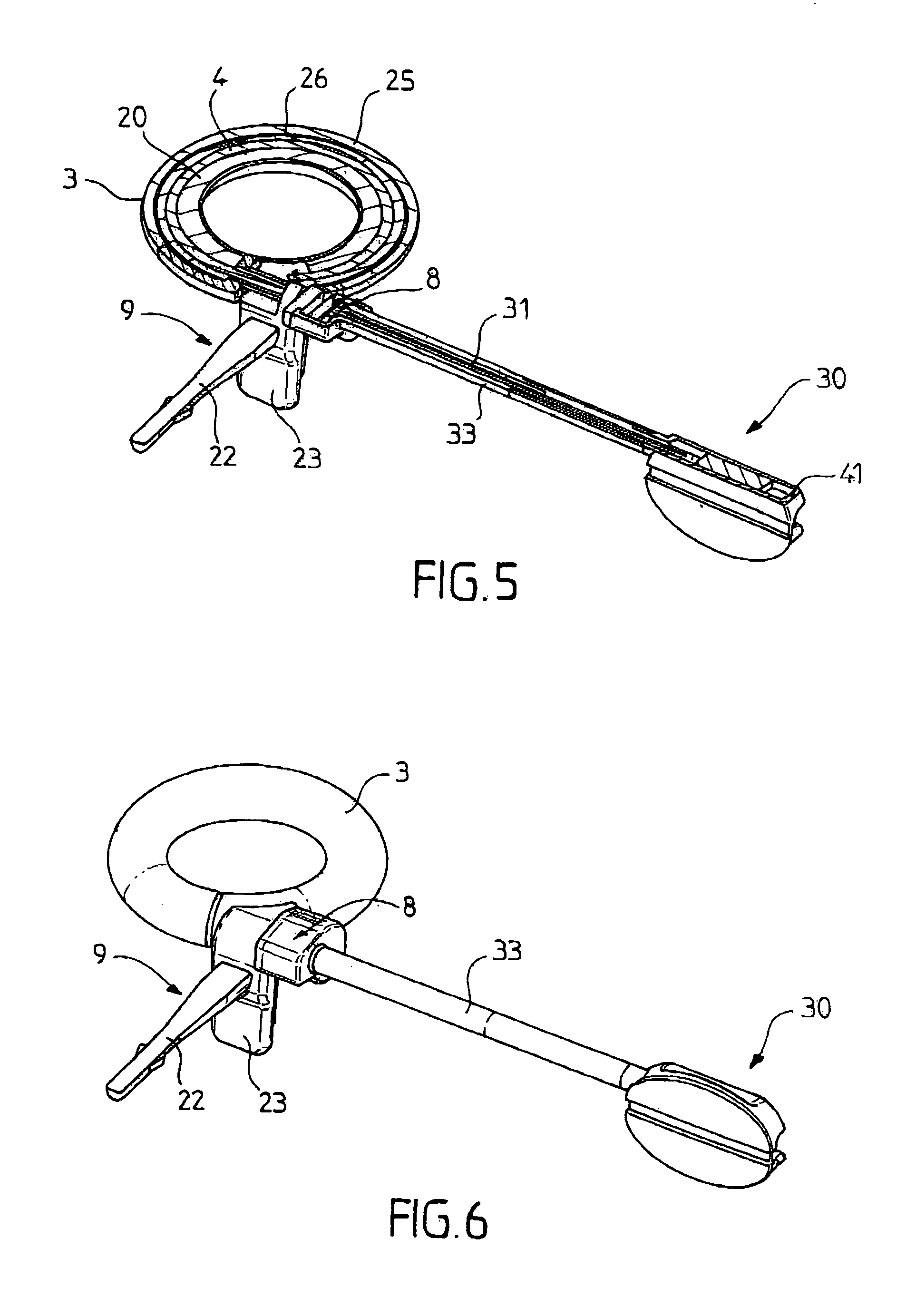 Surgical ring featuring a reversiblediameter remote control system