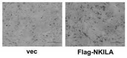 Application of long chain non-coded RNA-NKILA in bone tissue damage repair