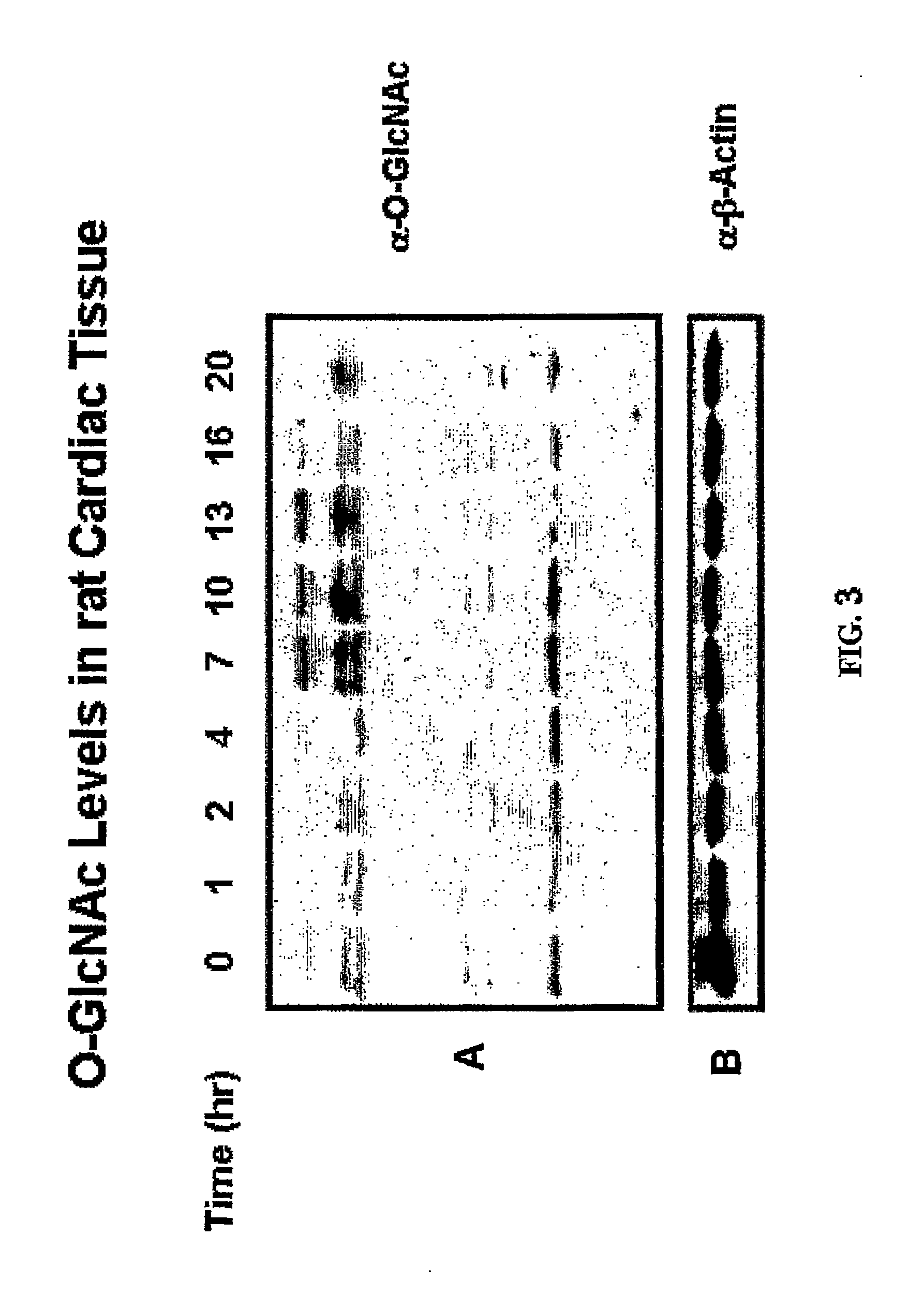 Selective glycosidase inhibitors and uses thereof