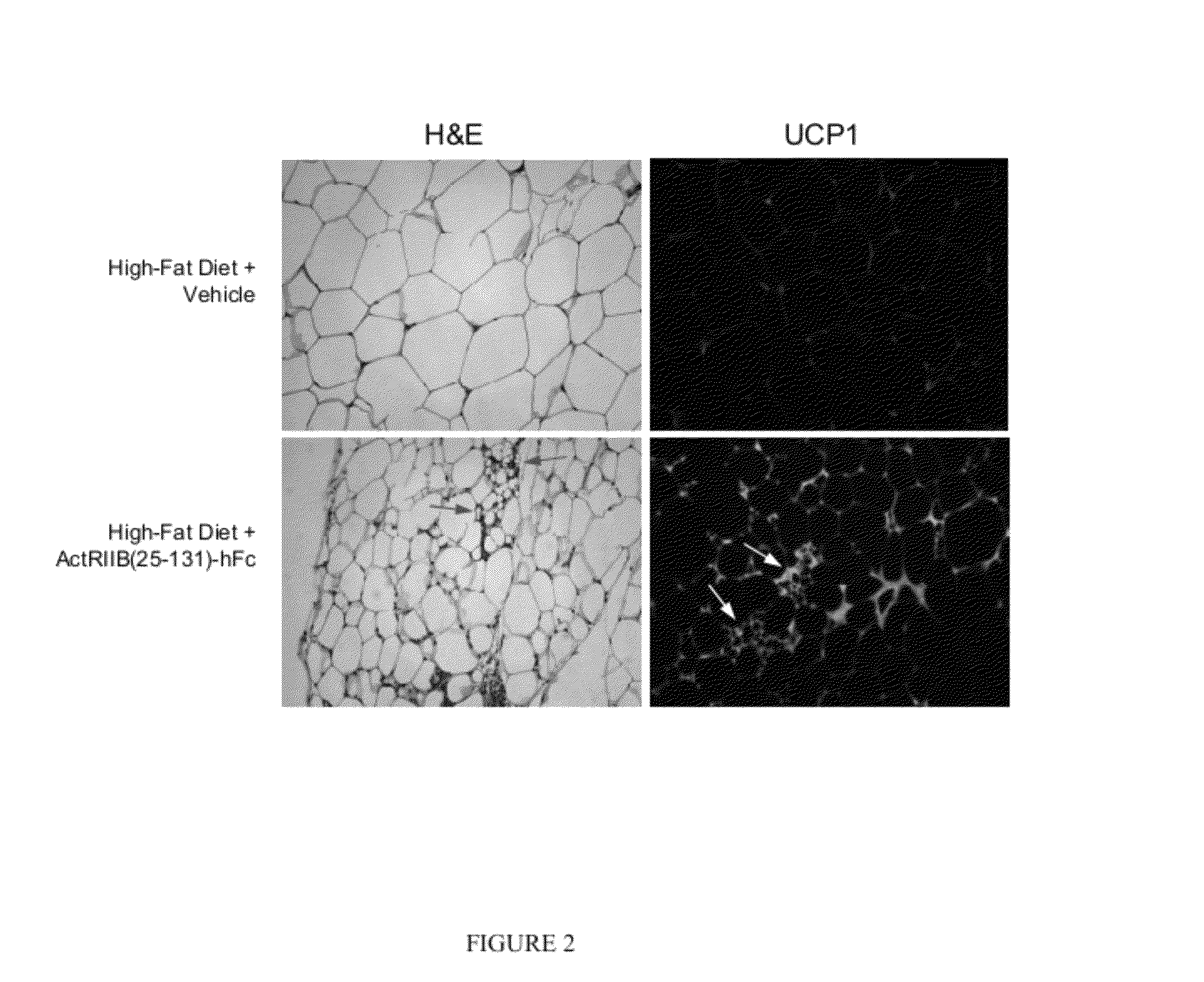 Methods for increasing thermogenic adipocytes