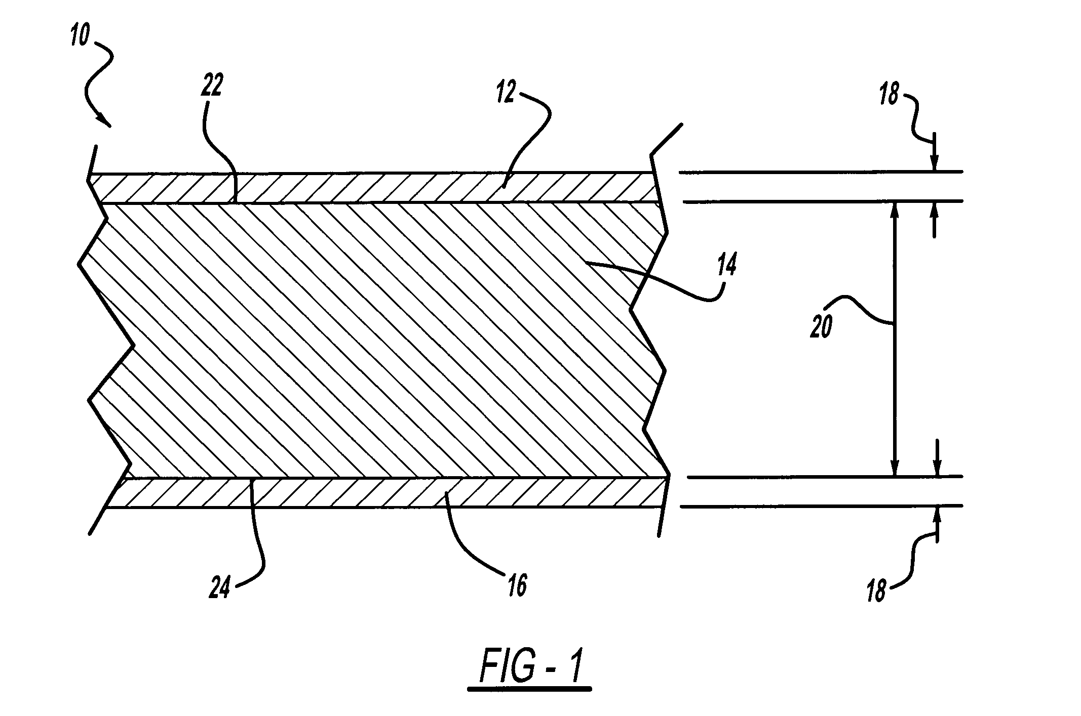 Sheet molding compound with cores