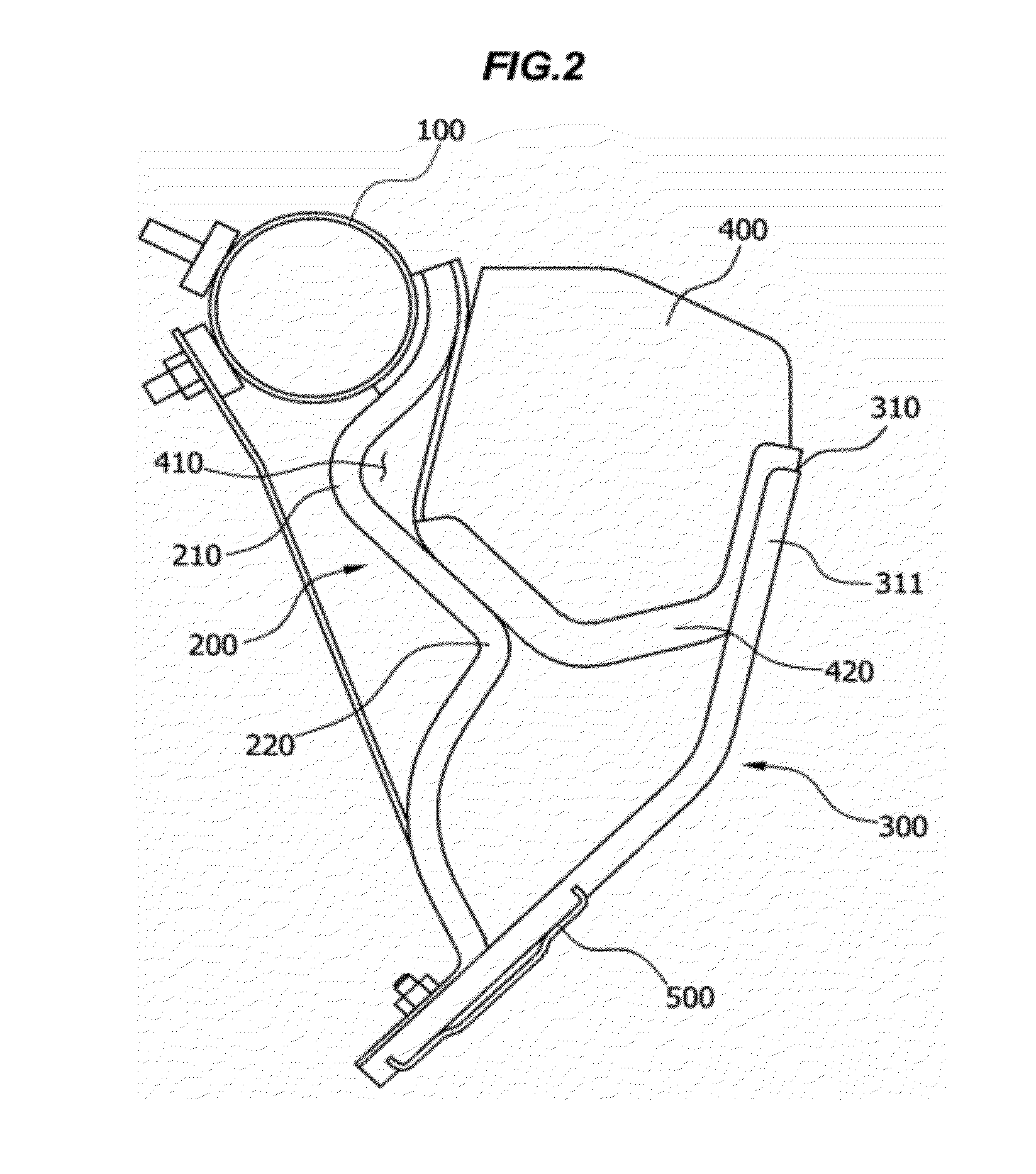 Driver knee bolster of automobile