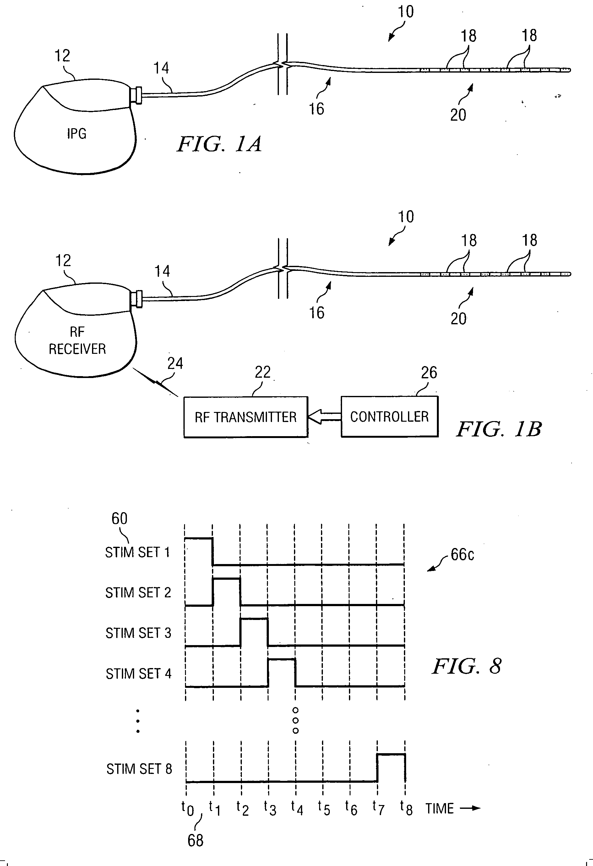 System and method for stimulation of a person's brain stem