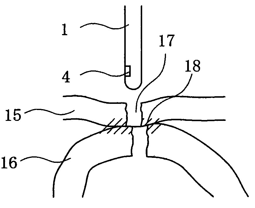 Instrument for re-insertion of a gastrostoma tube