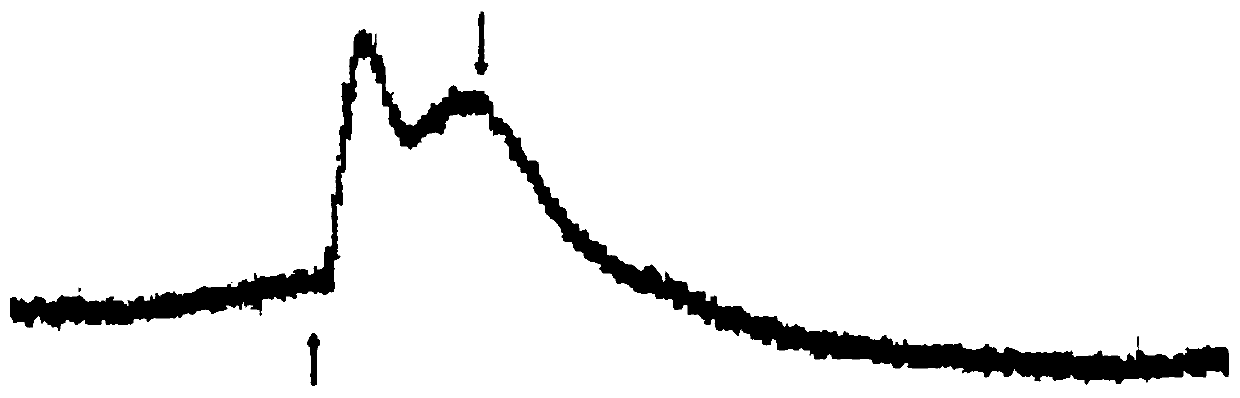 Application of Nobiletin in Preparation of Drugs for Treating Gastric Receptivity Disorder