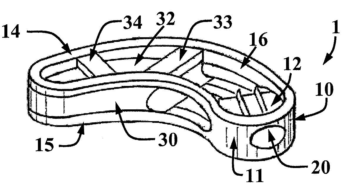 Expandable cage for vertebral surgery involving lumbar intersomatic fusion by a transforaminal posterior approach