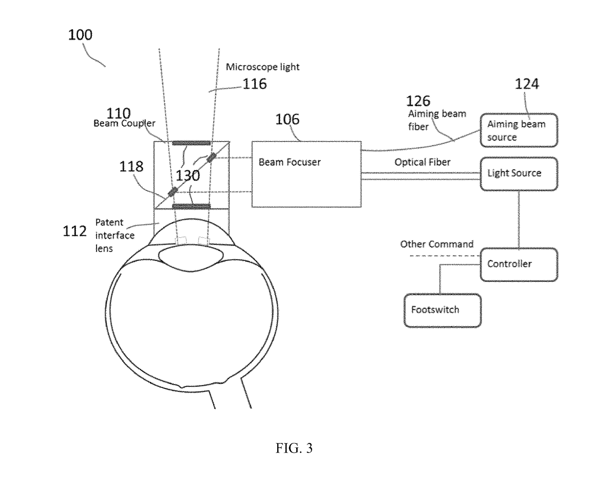 A surgical laser capsulorhexis system and patient interface lens accessory