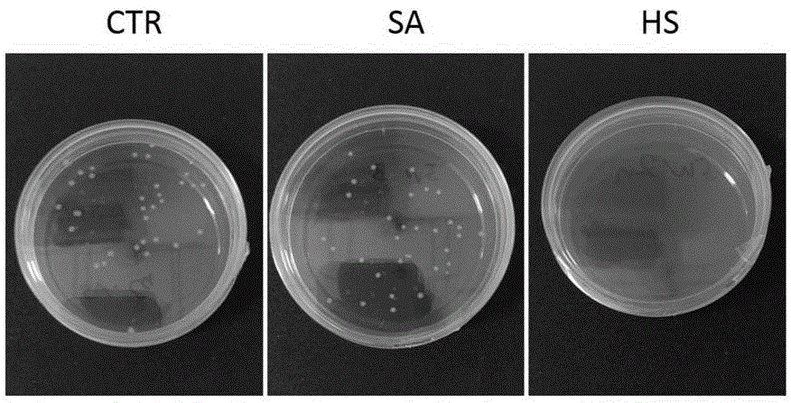 In-situ forming injectable bioactive composite hydrogel as well as preparation method and application thereof