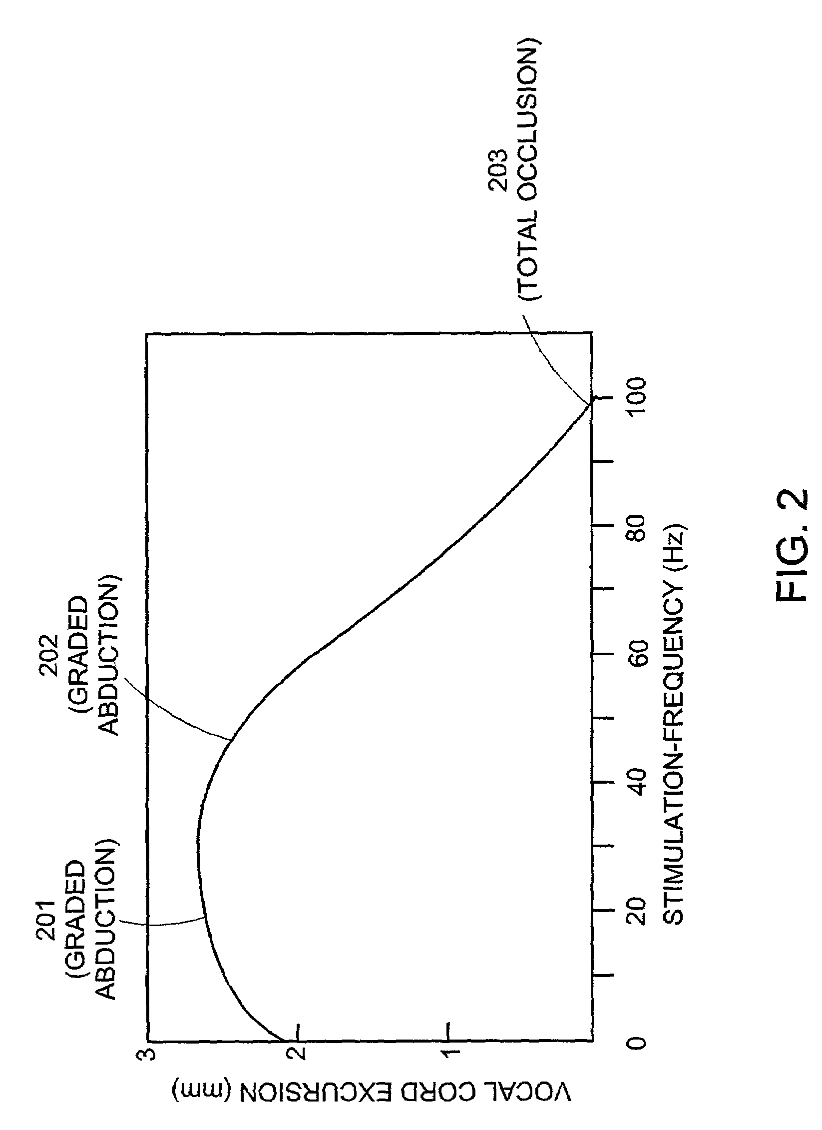 Pacemaker for bilateral vocal cord autoparalysis